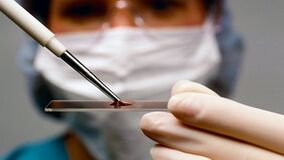 Diagnostic des arthrotes et de l'arthrose