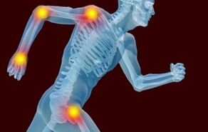 Les raisons du développement des arthrotes et de l'arthrose